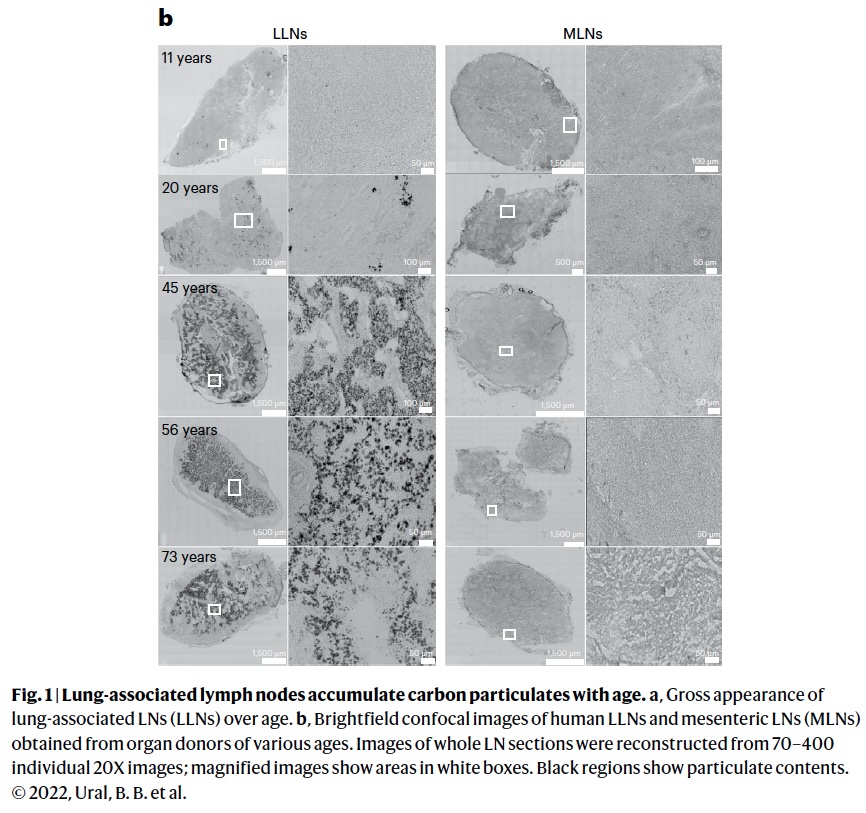 A different look at damaged lymph nodes showing the effects of air pollution [Nature, Vol. 28, Dec. 2022, pp. 2482-3]